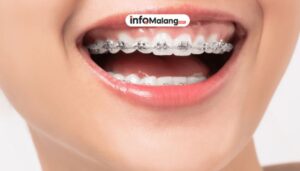 Sahabat Gigimu:  Klinik Gigi di Karangploso dengan Pelayanan Profesional dan Harga Terjangkau