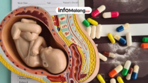 Jaksa Ajukan Tuntutan 5 Tahun dan 1,5 Tahun dalam Perkara Aborsi di Kabupaten Malang