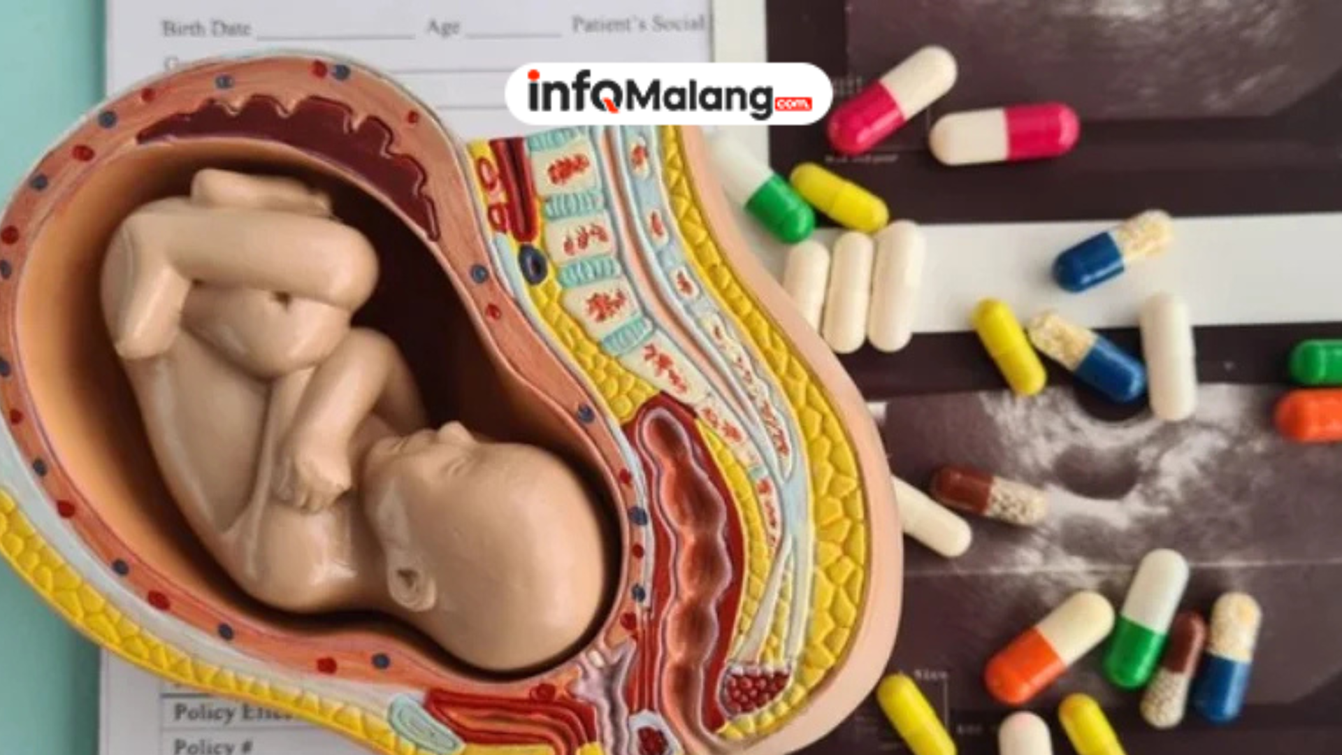 Jaksa Ajukan Tuntutan 5 Tahun dan 1,5 Tahun dalam Perkara Aborsi di Kabupaten Malang