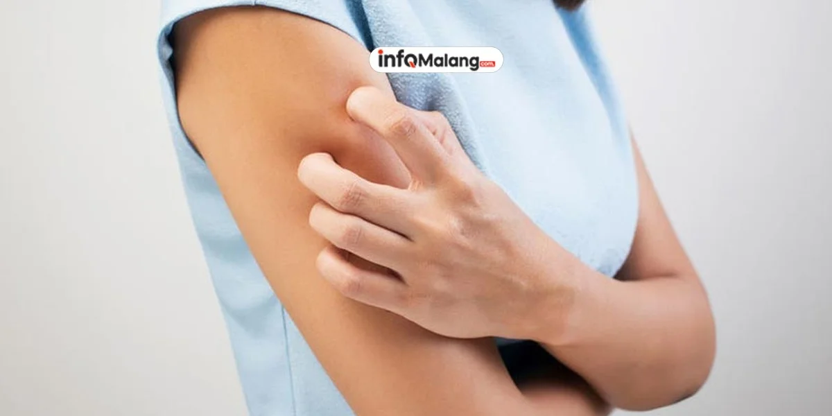 Cara Alami Mengatasi Kulit Kering Tanpa Obat Kimia