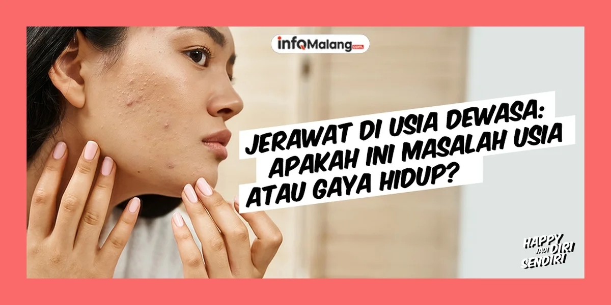 Jerawat Masalah Kulit yang Sering Dialami Remaja hingga Dewasa