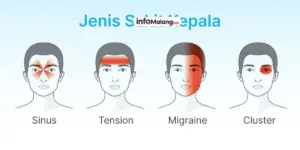 Migrain Penyebab, Gejala, dan Cara Mengurangi Serangan Sakit Kepala Berat