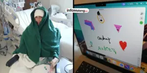 Pasien Neuralink Elon Musk Berhasil Tulis Nama di Komputer Hanya dengan Pikiran Setelah 20 Tahun